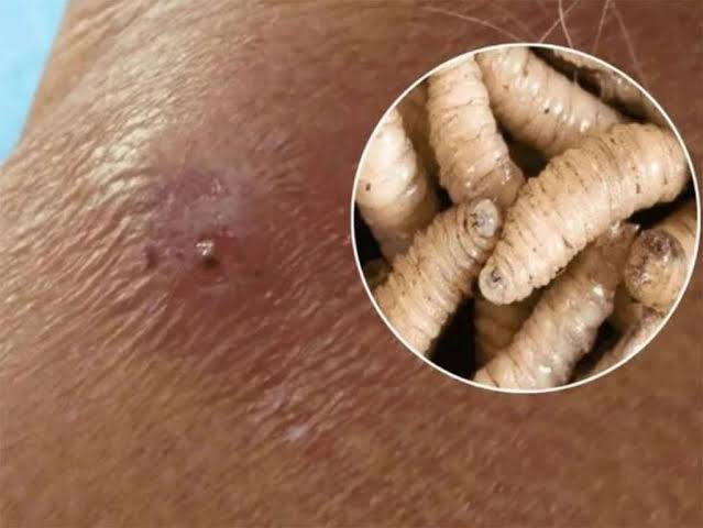 Confirman segundo caso humano de gusano barrenador en Tabasco y activan alerta sanitaria
