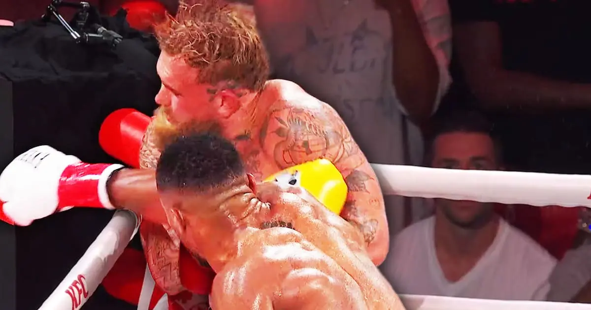 Jake Paul es operado de urgencia tras brutal nocaut de Anthony Joshua: sufrió fractura de mandíbula