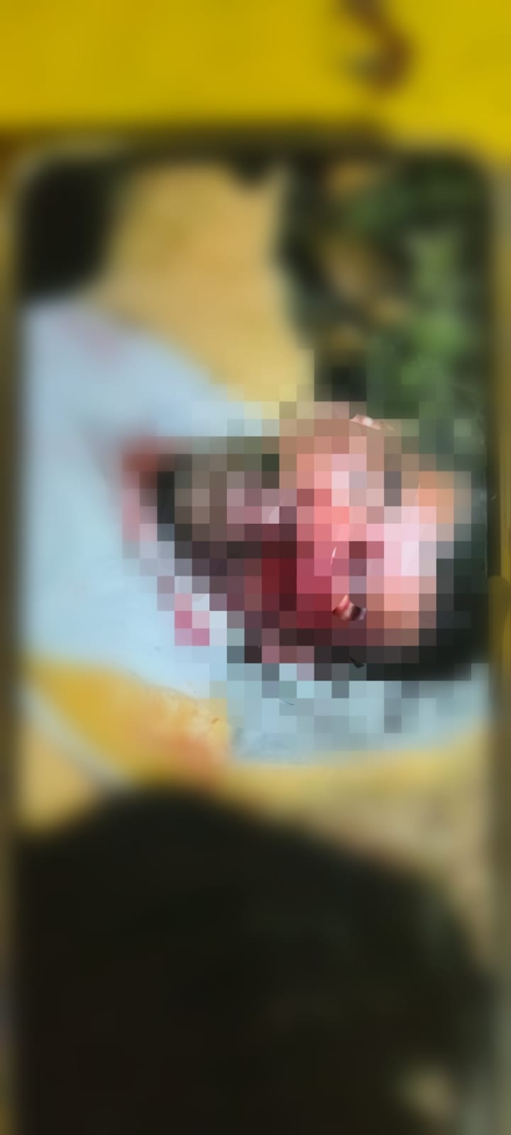 Brutal golpiza en Jolochero: tres sujetos dejan gravemente herido a un habitante de la misma comunidad